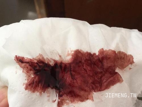 梦见自己下面流血