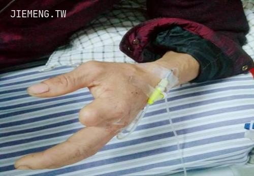 梦见被蛇咬手指